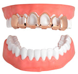Open Face Grillz Custom Fit 14k Rose Gold Plated Top Bottom Teeth Grill