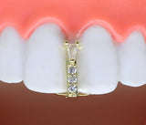 Thin Cubic Zirconia Gap Grillz 14k Gold Plated Teeth Top or Lower Grill + Case