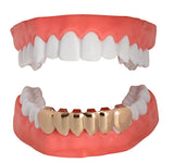 Bottom Grillz Custom Fit 6 Tooth Lower Cap w/ Mold